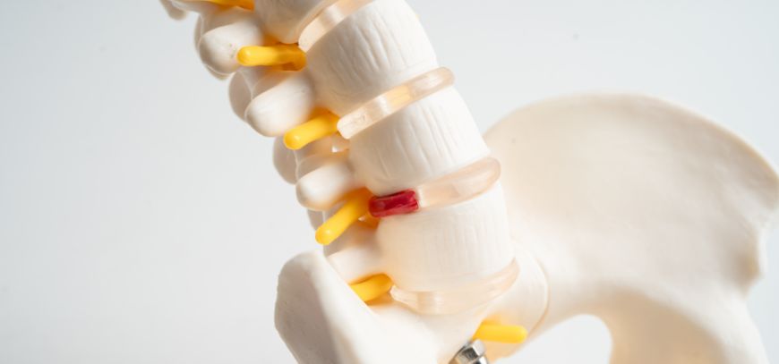 herniated disc treatment orange county ca herniated disc treatment orange county ca